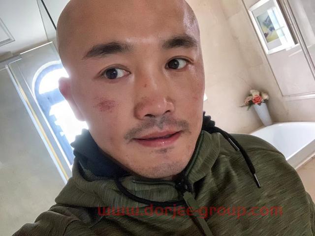 播求懸了！武僧一龍為復(fù)出戰(zhàn)惡補(bǔ)西洋參，自信KO泰拳王